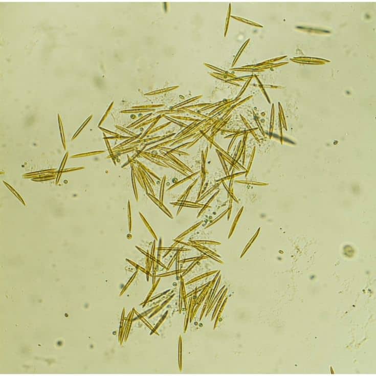 Microorganisms - diatoms