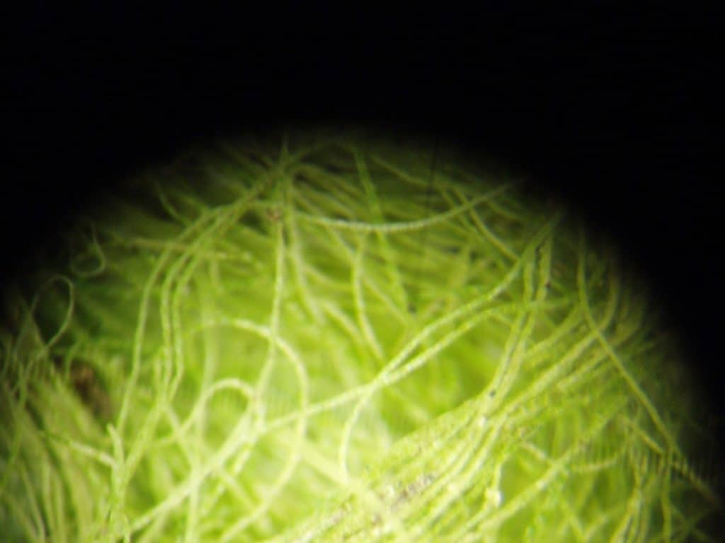 Rhizoclonium Algae