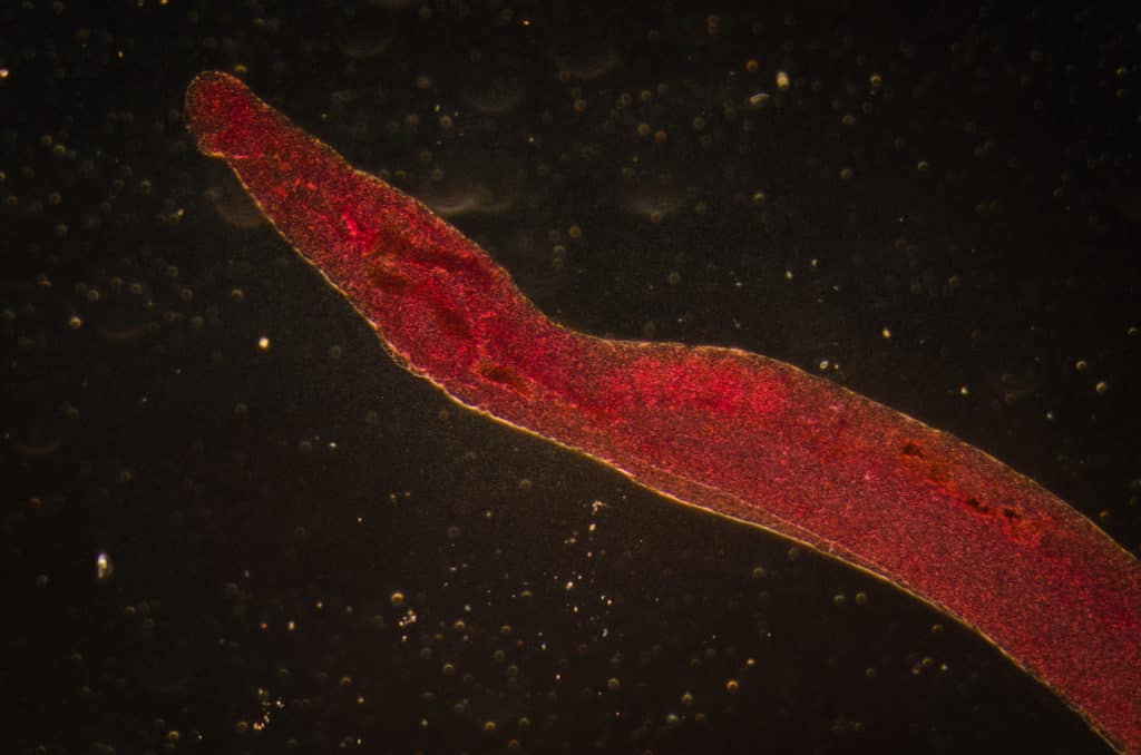 medical microscopy animal parasiteras schistosome blood flukes