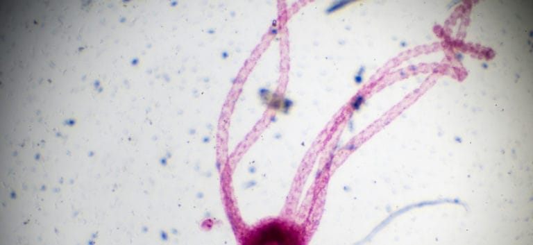Hydra under light microscopy