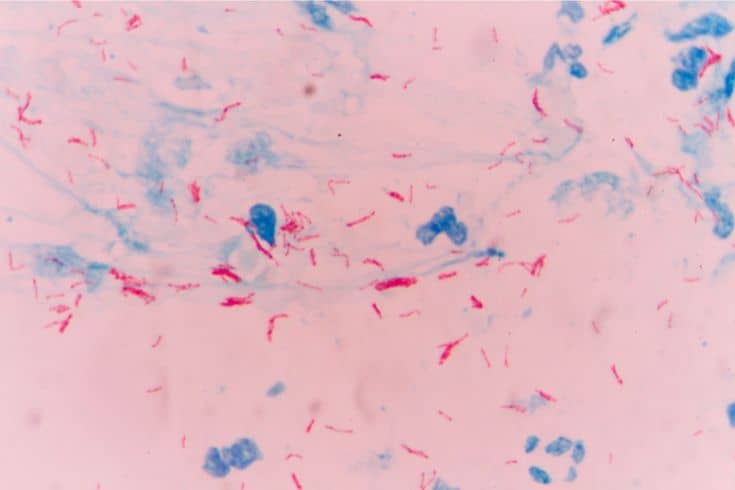 Mycobacterium infection